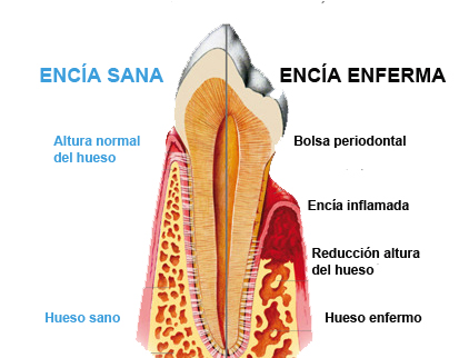 periodonciawebok