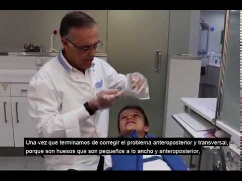 thumb Dr. Boccio – Caso clinico Jose Maria